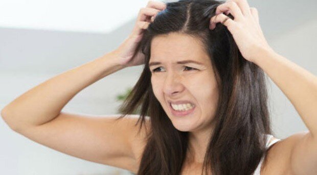 Penyebab Kulit Kepala Gatal dan Cara Mengatasinya